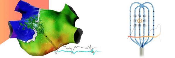 Johnson Johnson MedTech Receives CE Mark For OPTRELL Mapping Johnson Johnson MedTech Receives CE Mark For OPTRELL Mapping